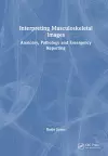 Interpreting Musculoskeletal Images cover