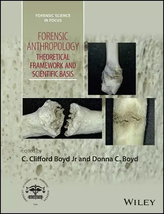 Forensic Anthropology cover