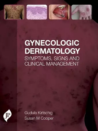 Gynecologic Dermatology cover