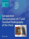 Comparative Interpretation of CT and Standard Radiography of the Chest cover