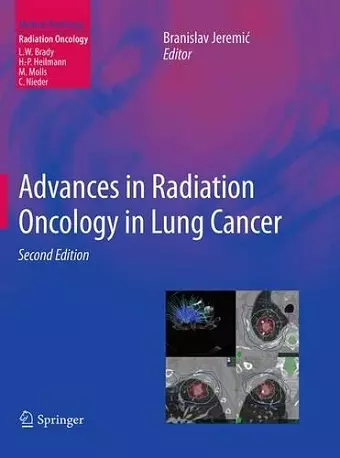 Advances in Radiation Oncology in Lung Cancer cover