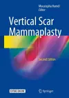 Vertical Scar Mammaplasty cover